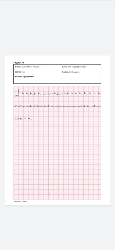 Report misurazione ECG Wellue Armfit Plus con App ViHealth