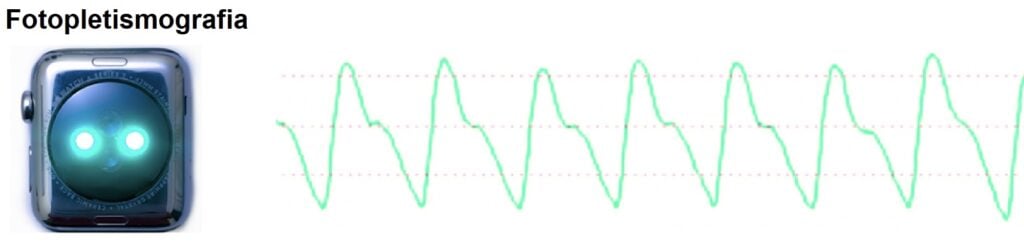 Utilizzo della fotopletismografia (PPG) negli smartwatch per rilevare il battito cardiaco